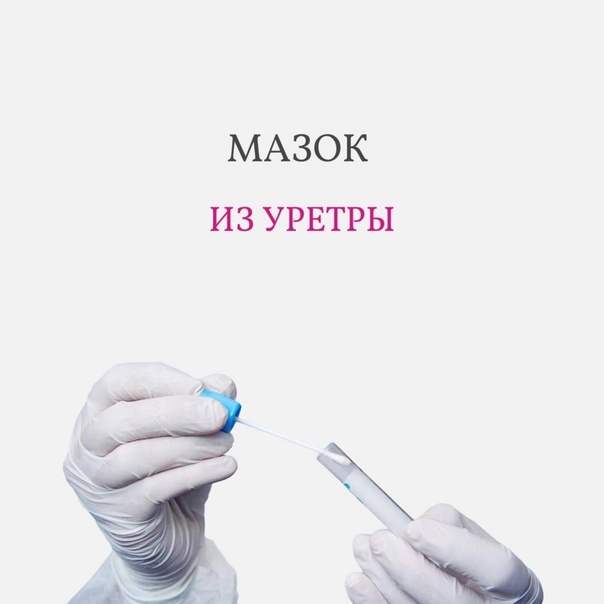 Урологические анализы. Мазок из уретры.