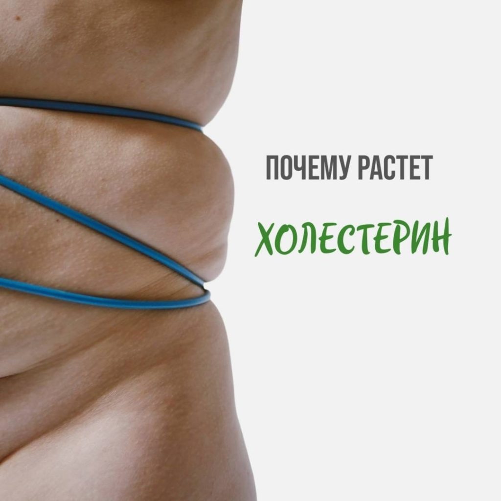 Почему растёт холестерин