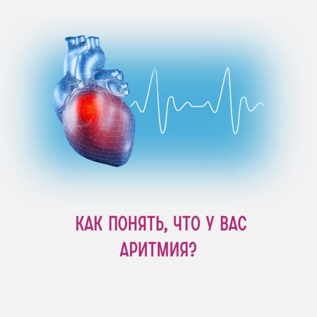 Как опеределить аритмию?