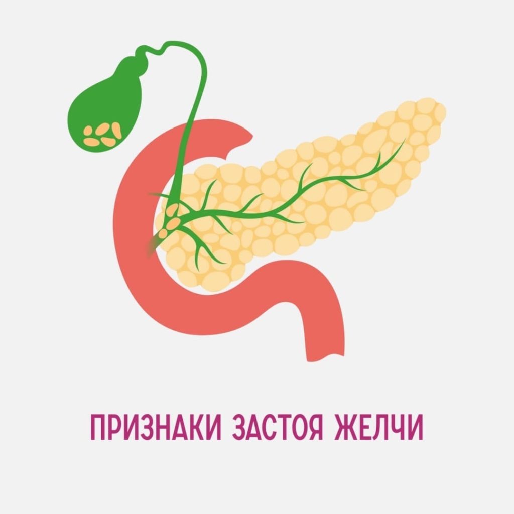 Признаки застоя желчи
