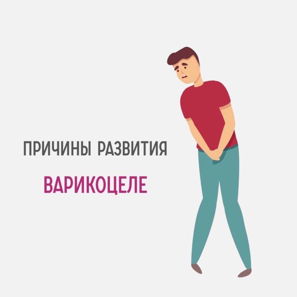 Причины развития Варикоцеле